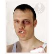 Boxer Teeth