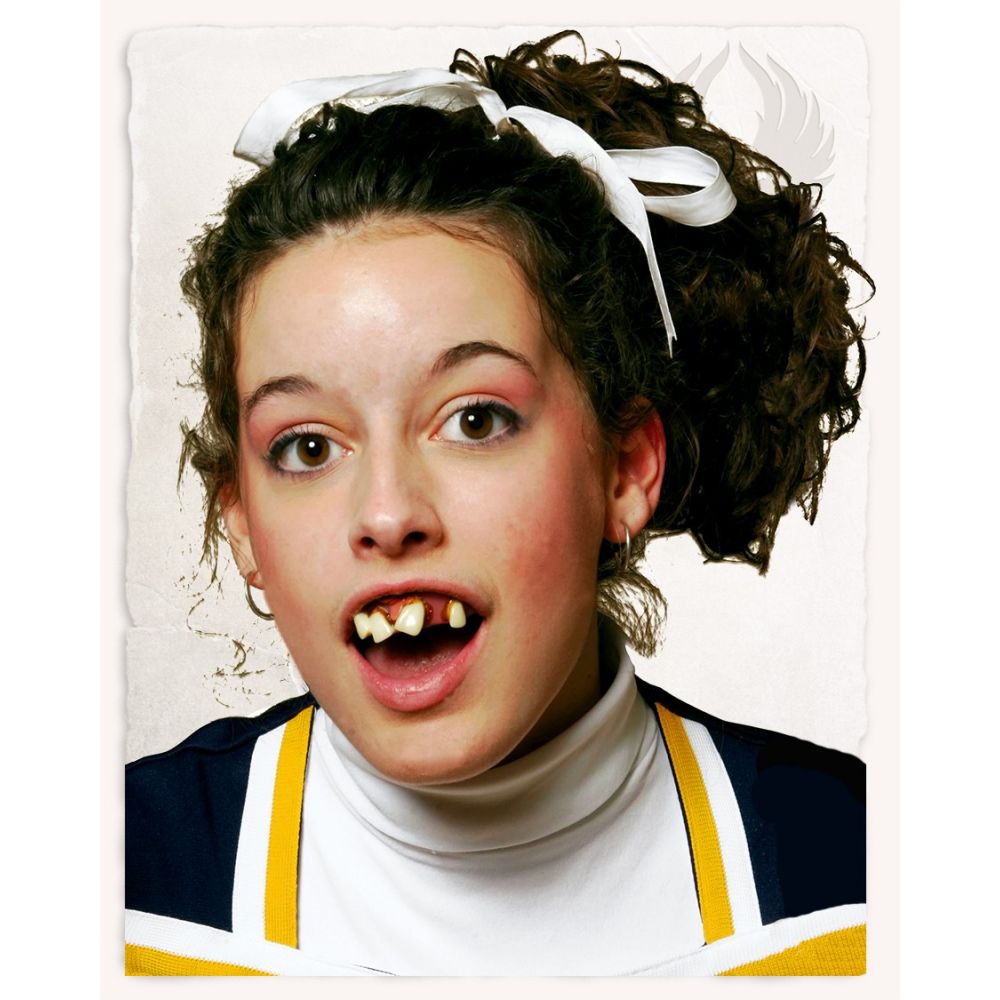 Cheerleader Teeth
